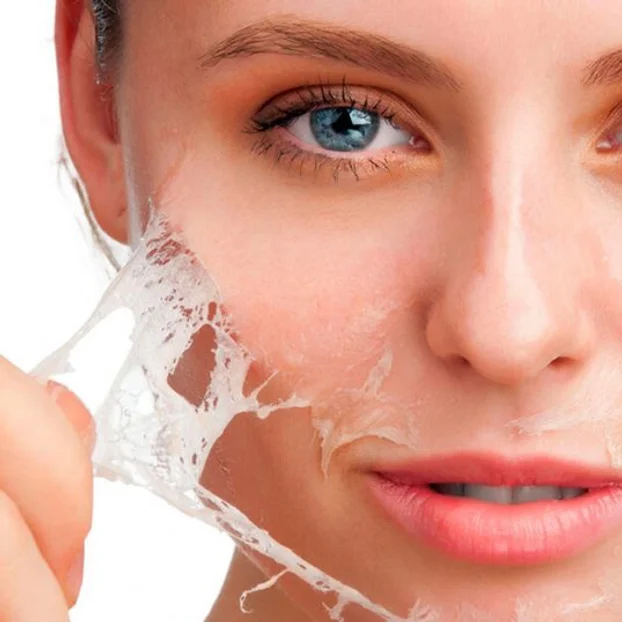 Chemical Peeling