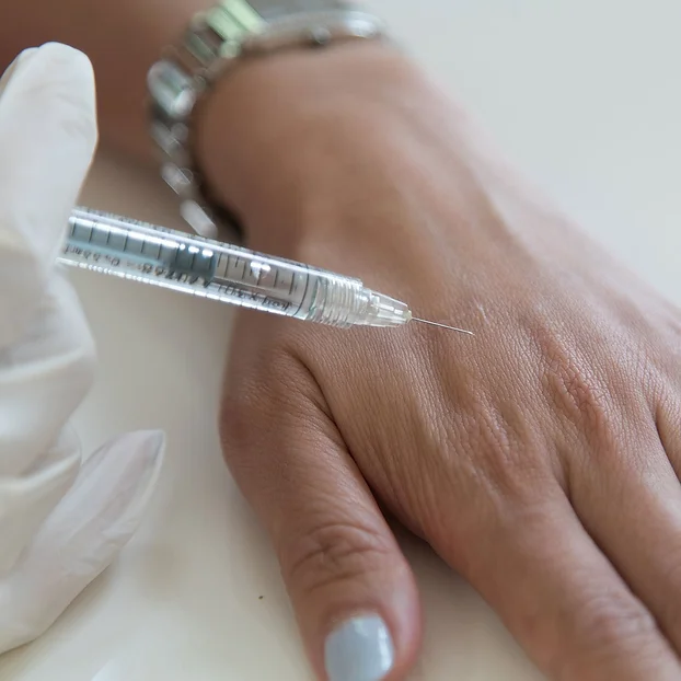 Hand Rejuvenation Treatment